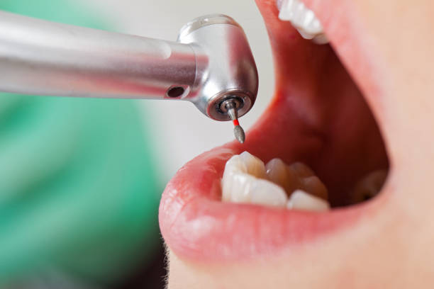 Best Emergency Dental Services for Seniors in Lake Brownwood, TX